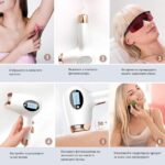 Фотоепилатор - PHOTON HAIR REMOVAL INSTRUMENT - MY006, - Image 3